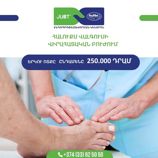 Հալուքս վալգուսի բուժում․ 2 ոտքը 250․000դր